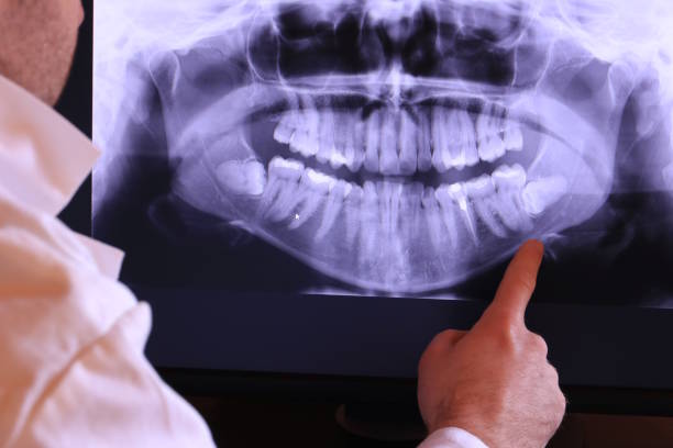Best Emergency Root Canal Treatment in Lovejoy, GA