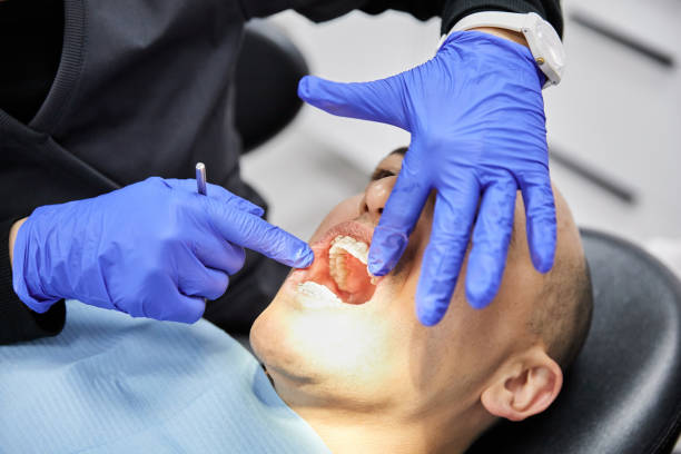 Best Emergency Tooth Extraction in Lovejoy, GA